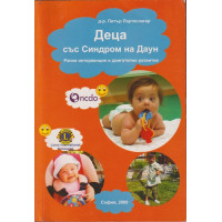 Деца със Синдром на Даун