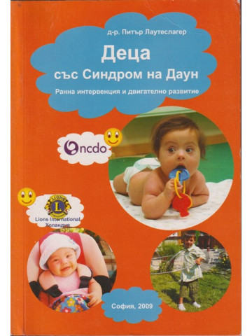 Деца със Синдром на Даун